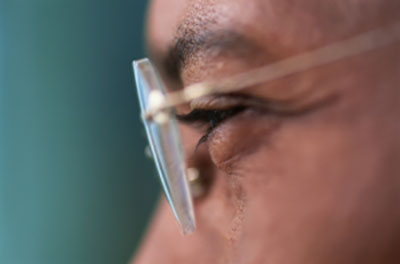 Eyelid Surgery Philadelphia