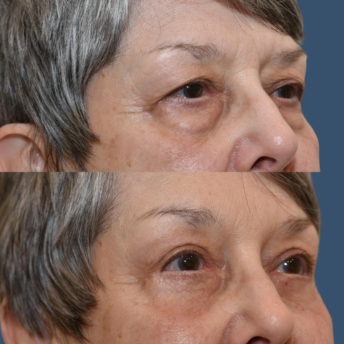 Cosmetic Facial Surgery Options Before & After Gallery - Patient 809666 - Image 2
