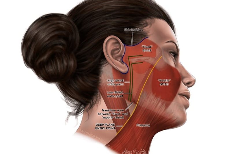illustration of the layers of the face