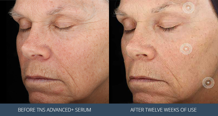Skin Before and After