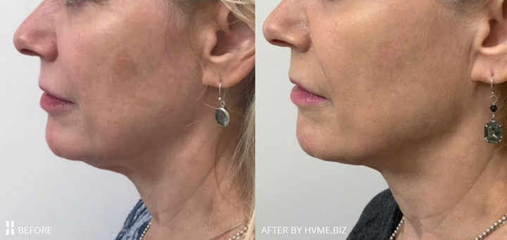patient results