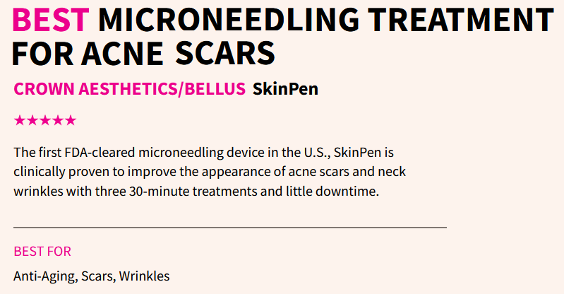 best treatment for acne scars