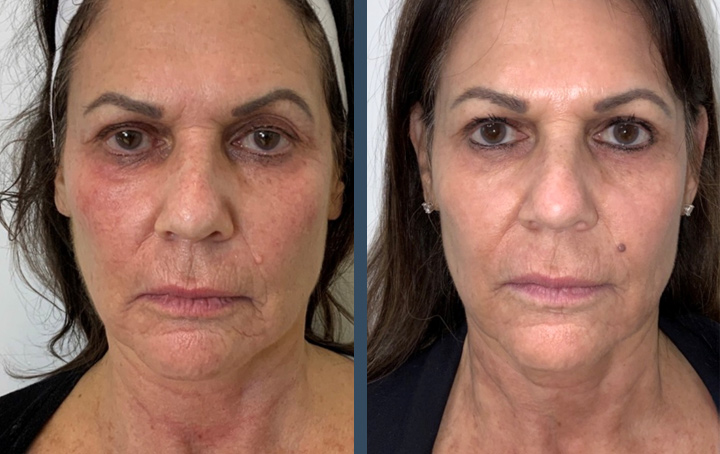 patient results