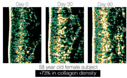 skinade-cortex-collagen-scans