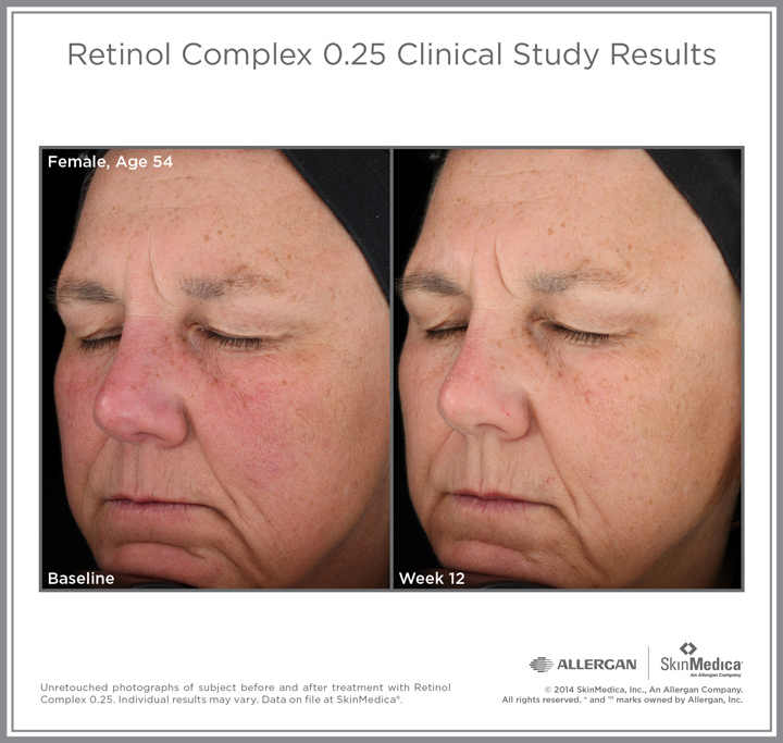 Patient results