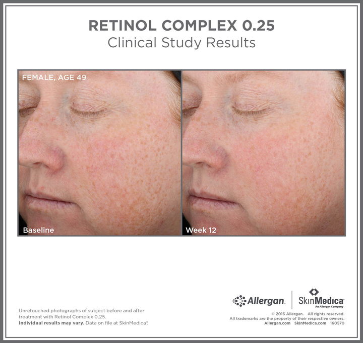 Patient results