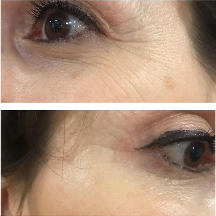 SkinMedica Instant Bright Eye Mask