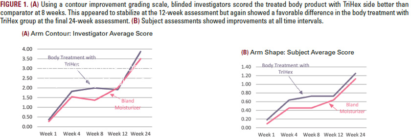 graphs