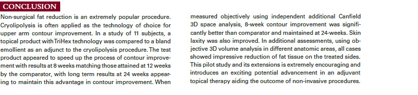 article excerpt