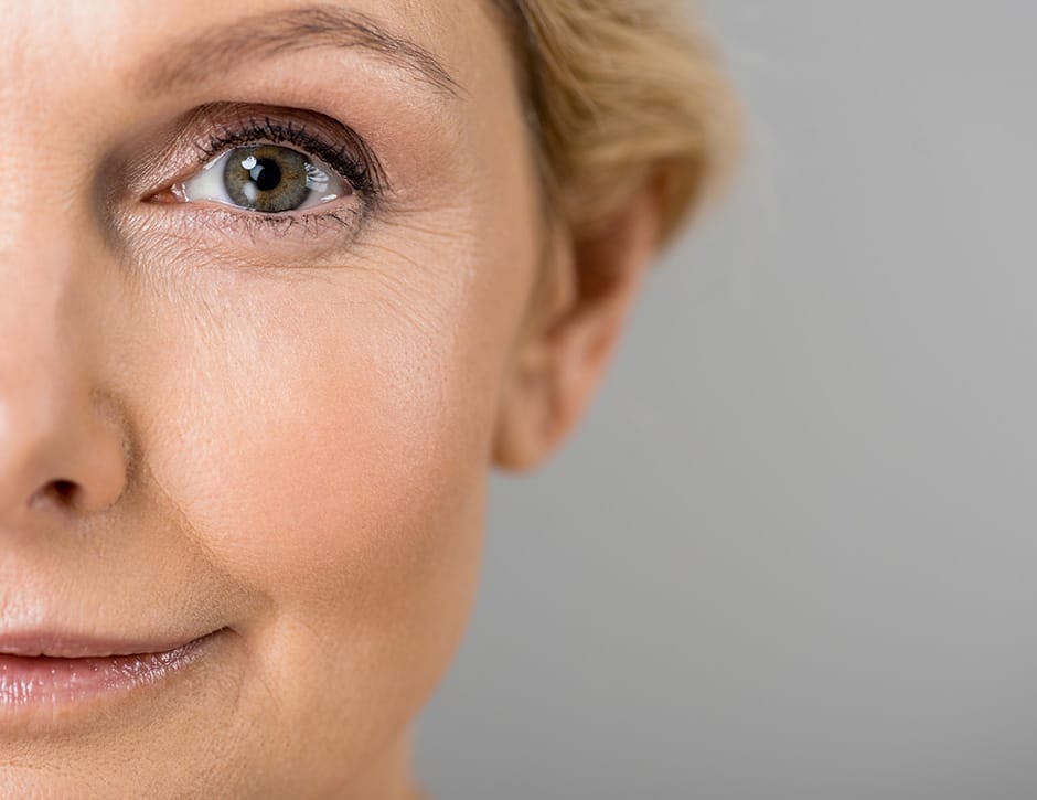 half of a woman's face showing the wrinkles around her eye