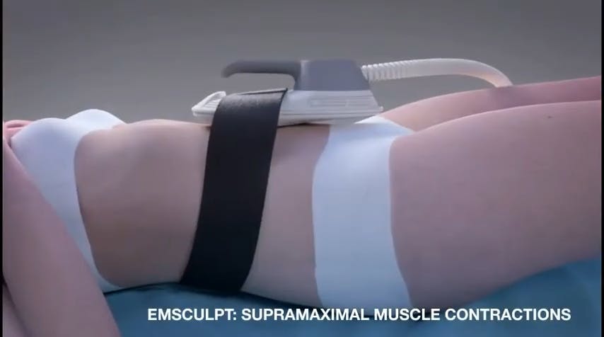 emsculpt video
