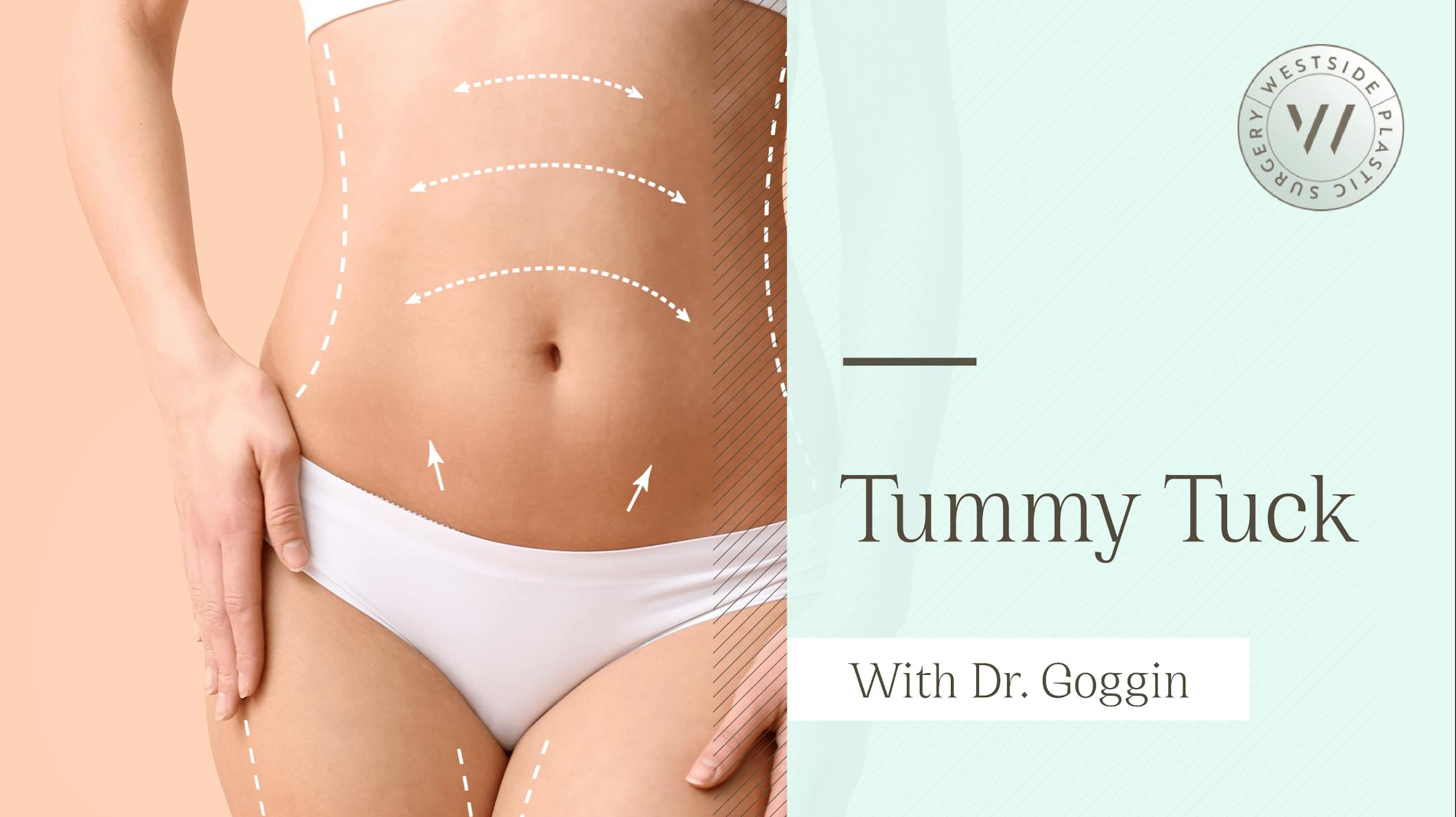Tummy tuck video thumbnail