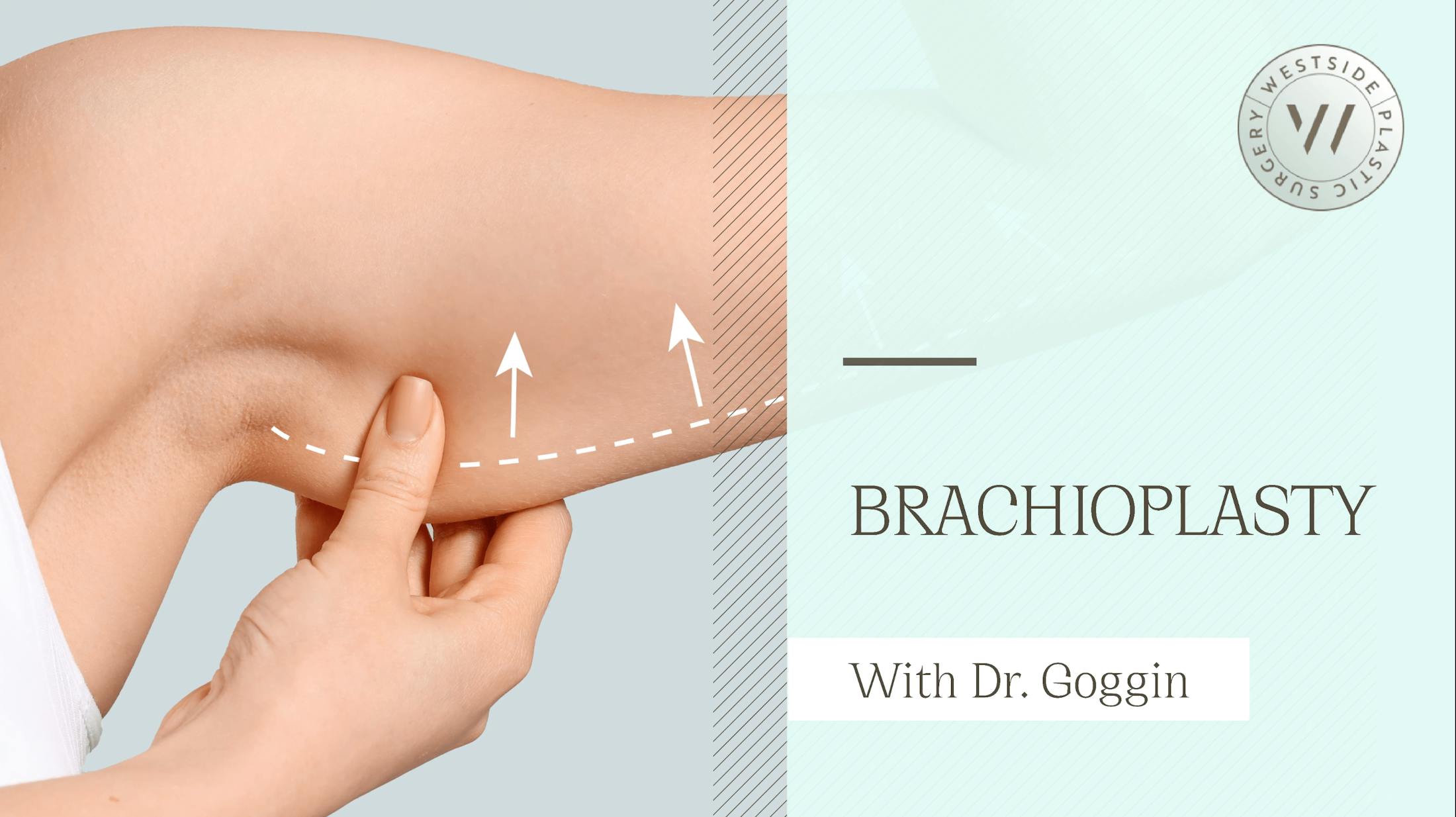 Brachioplasty video thumbnail