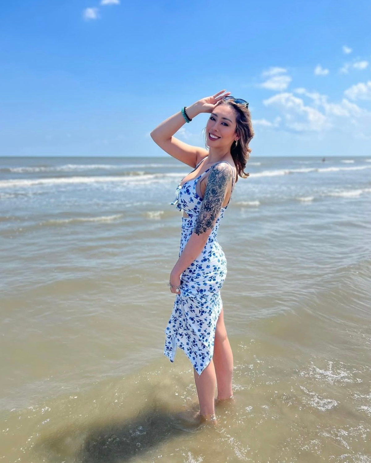 Patient Selfies Before & After Gallery - Patient 380751 - Image 1