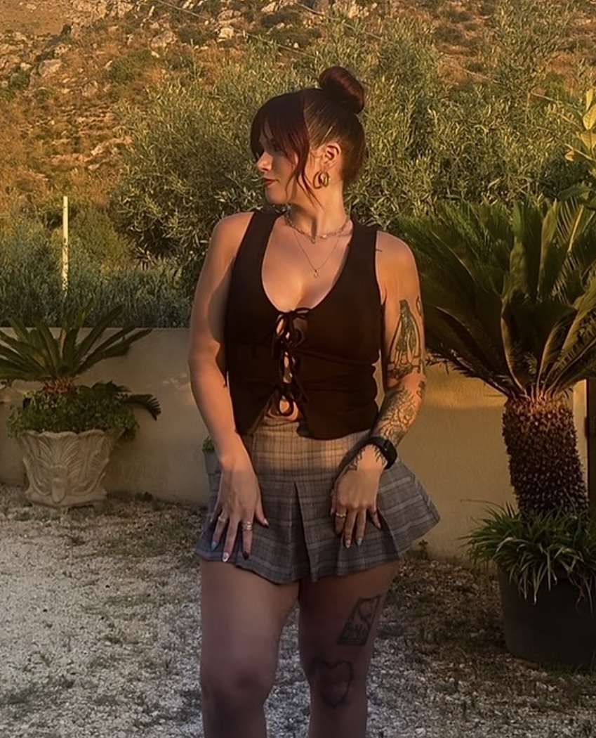 Patient Selfies Before & After Gallery - Patient 418343 - Image 1