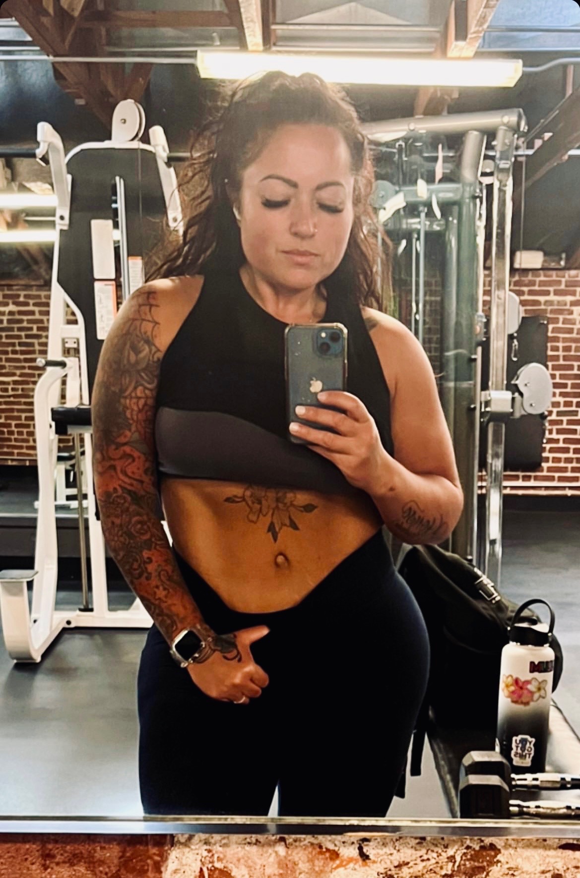 Patient Selfies Before & After Gallery - Patient 135791 - Image 1