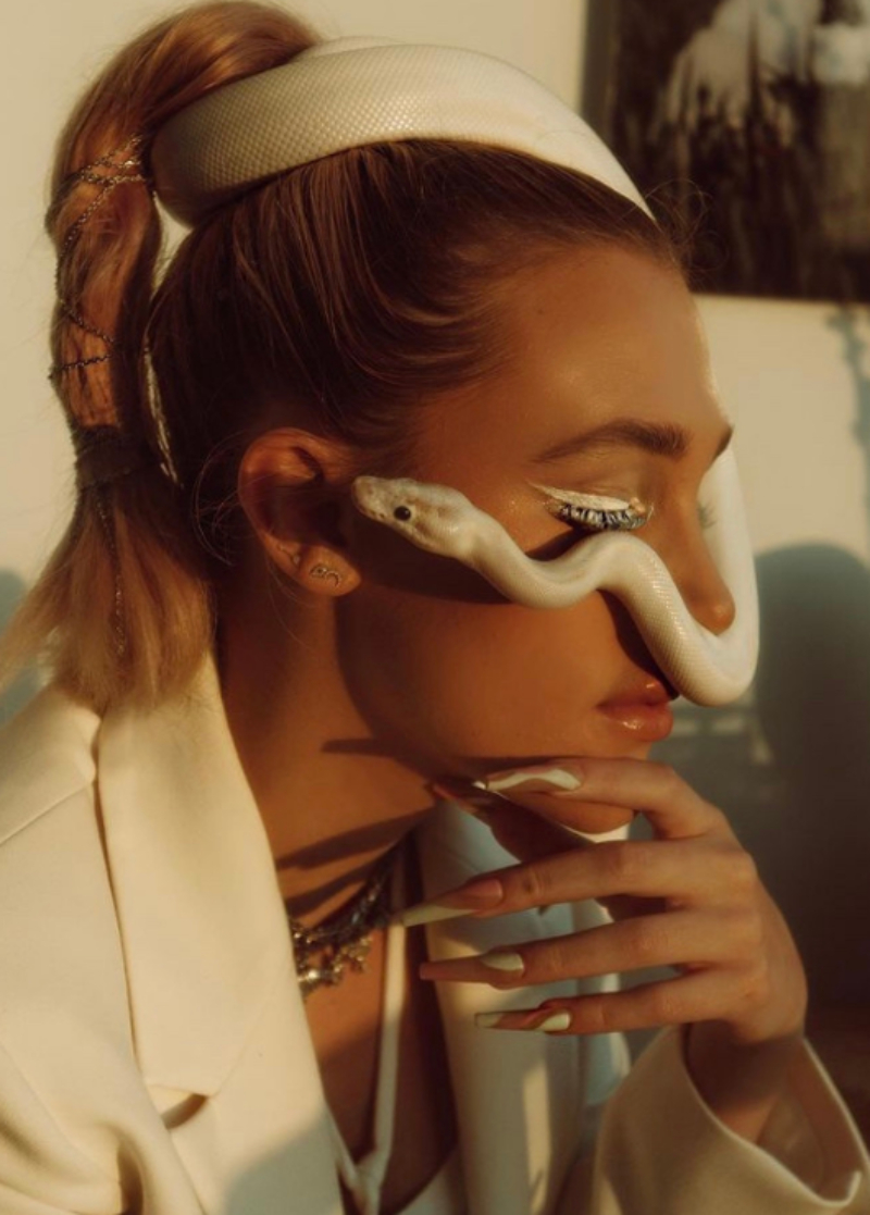 Madi Monroe - non surgical rhinoplasty patient