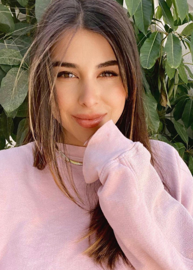 Daniella Monet - closed rhinoplasty tip refinement patient