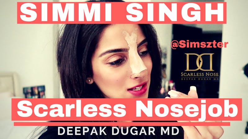 Simmi Singh Scarless Nosejob