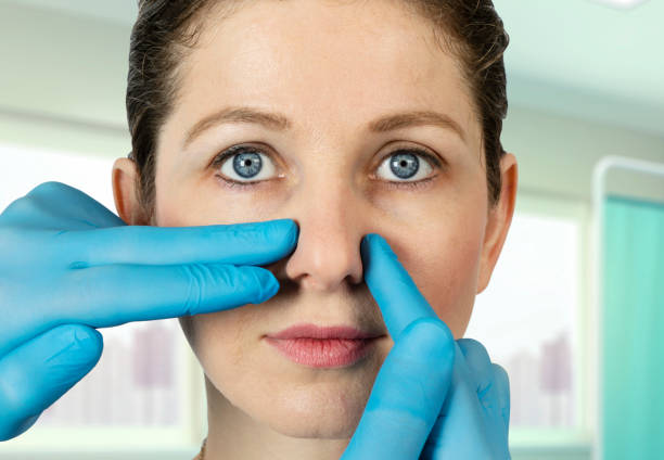 A plastic surgeon examining a nose of a female patient after closed rhinoplasty