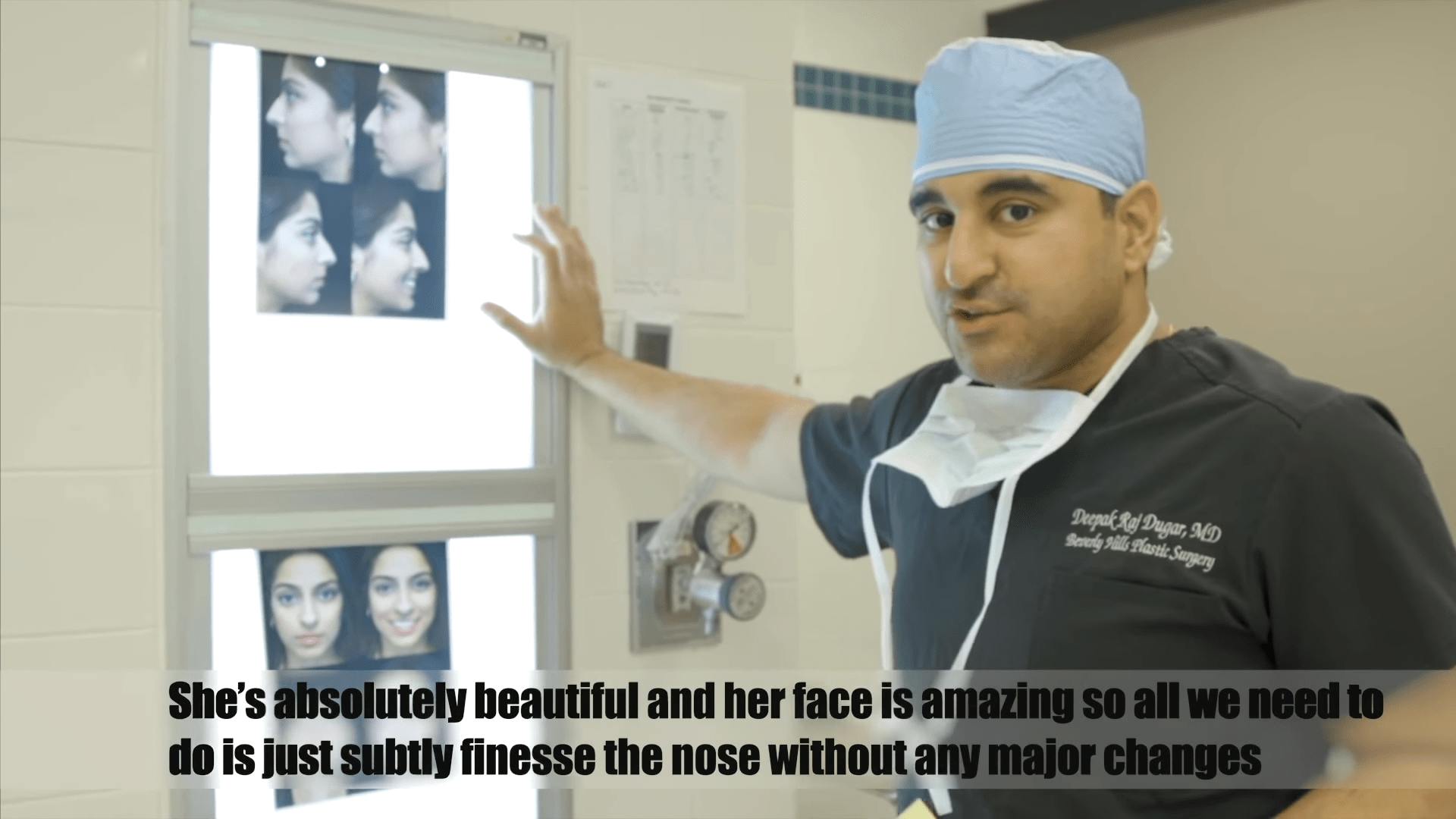 Beverly Hills Rhinoplasty