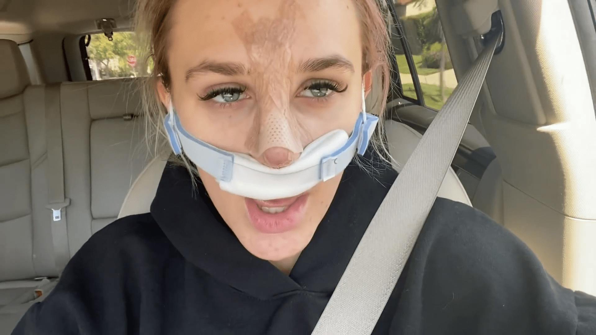 Beverly Hills Rhinoplasty