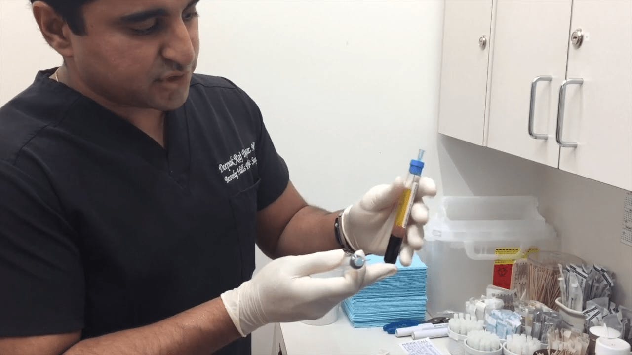 Beverly Hills Rhinoplasty