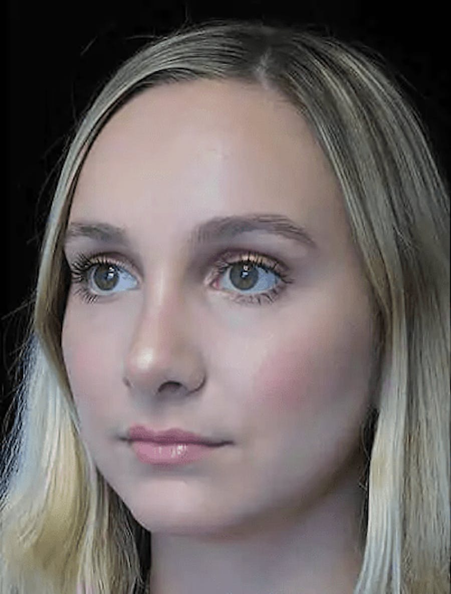 out of town example image