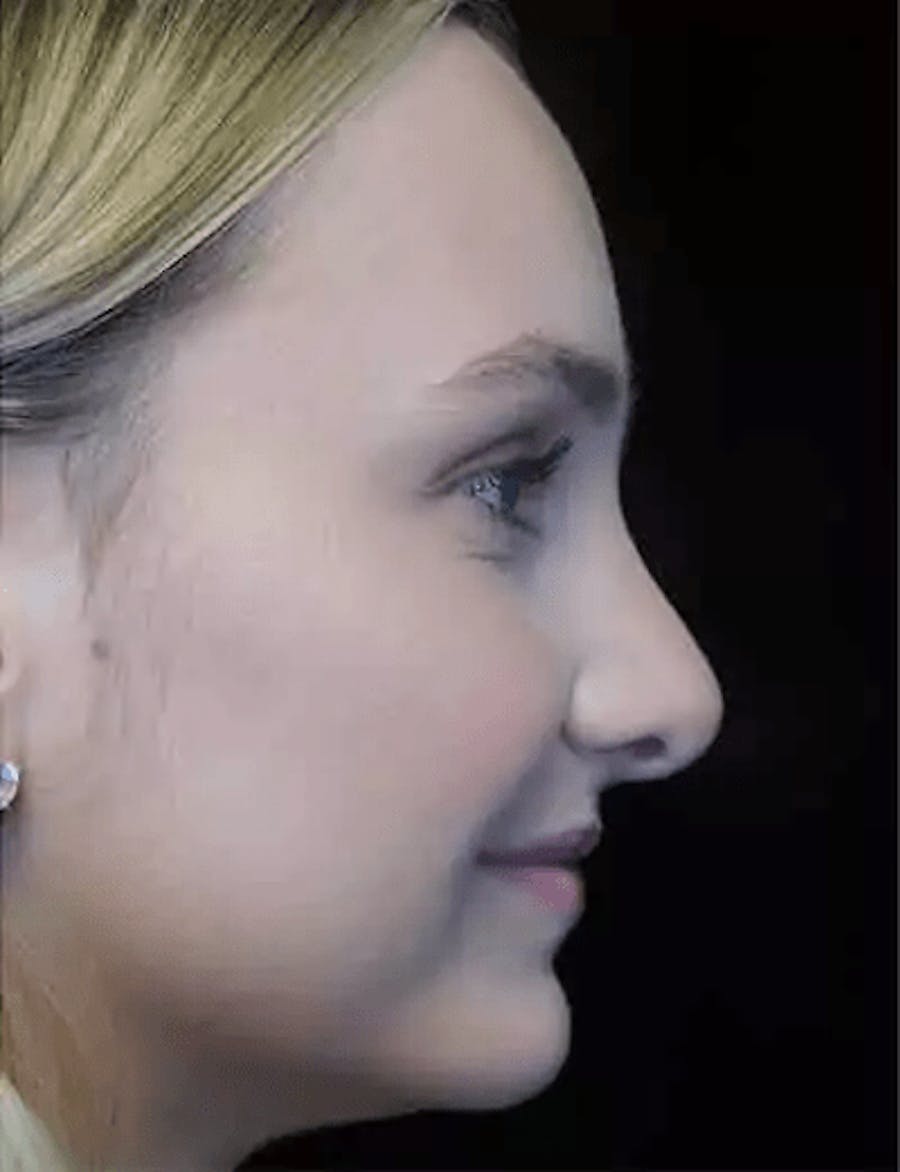 out of town example image