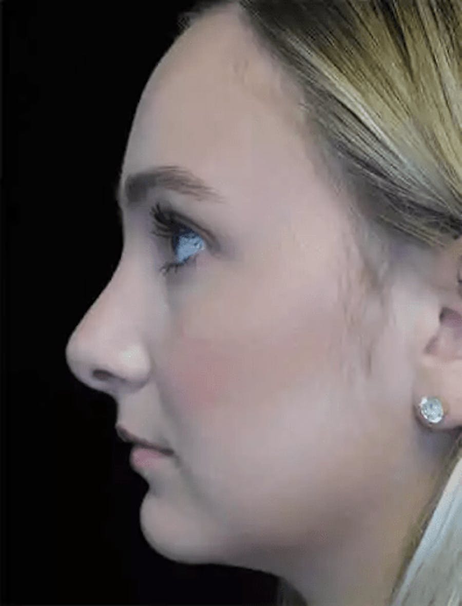 out of town example image