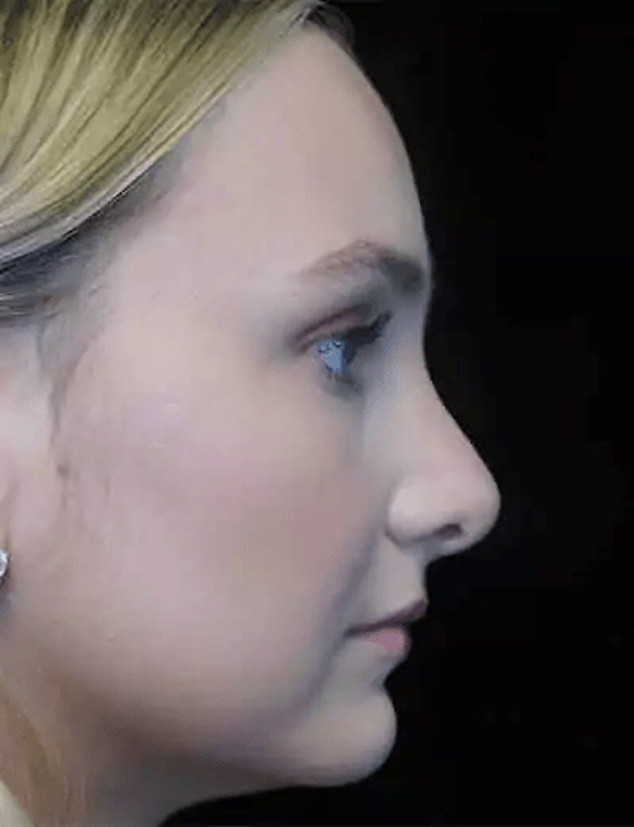 out of town example image