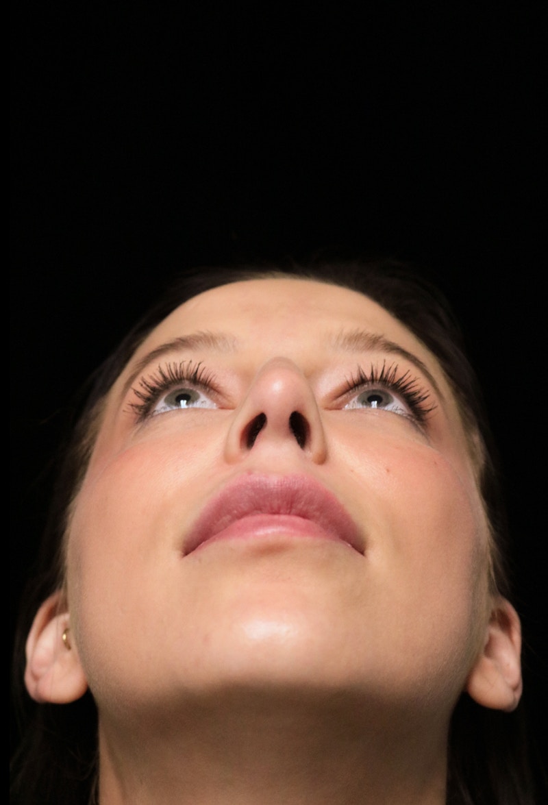 Beverly Hills Rhinoplasty Before & After Gallery - Patient 241548 - Image 7 Dr. Deepak Raj Dugar