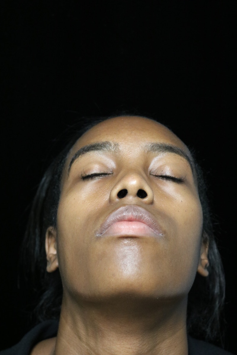 Beverly Hills Rhinoplasty Before & After Gallery - Patient 165692 - Image 7 Dr. Deepak Raj Dugar