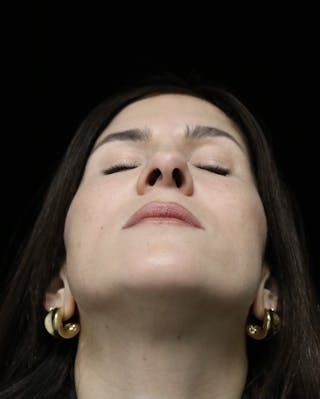 Beverly Hills Rhinoplasty Before & After Gallery - Patient 346052 - Image 8 Dr. Deepak Raj Dugar