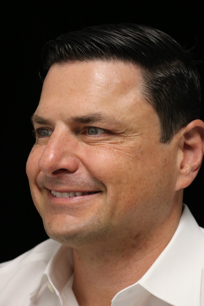 Beverly Hills Non-Surgical Before & After Gallery - Patient 406256 - Image 12 Dr. Deepak Raj Dugar