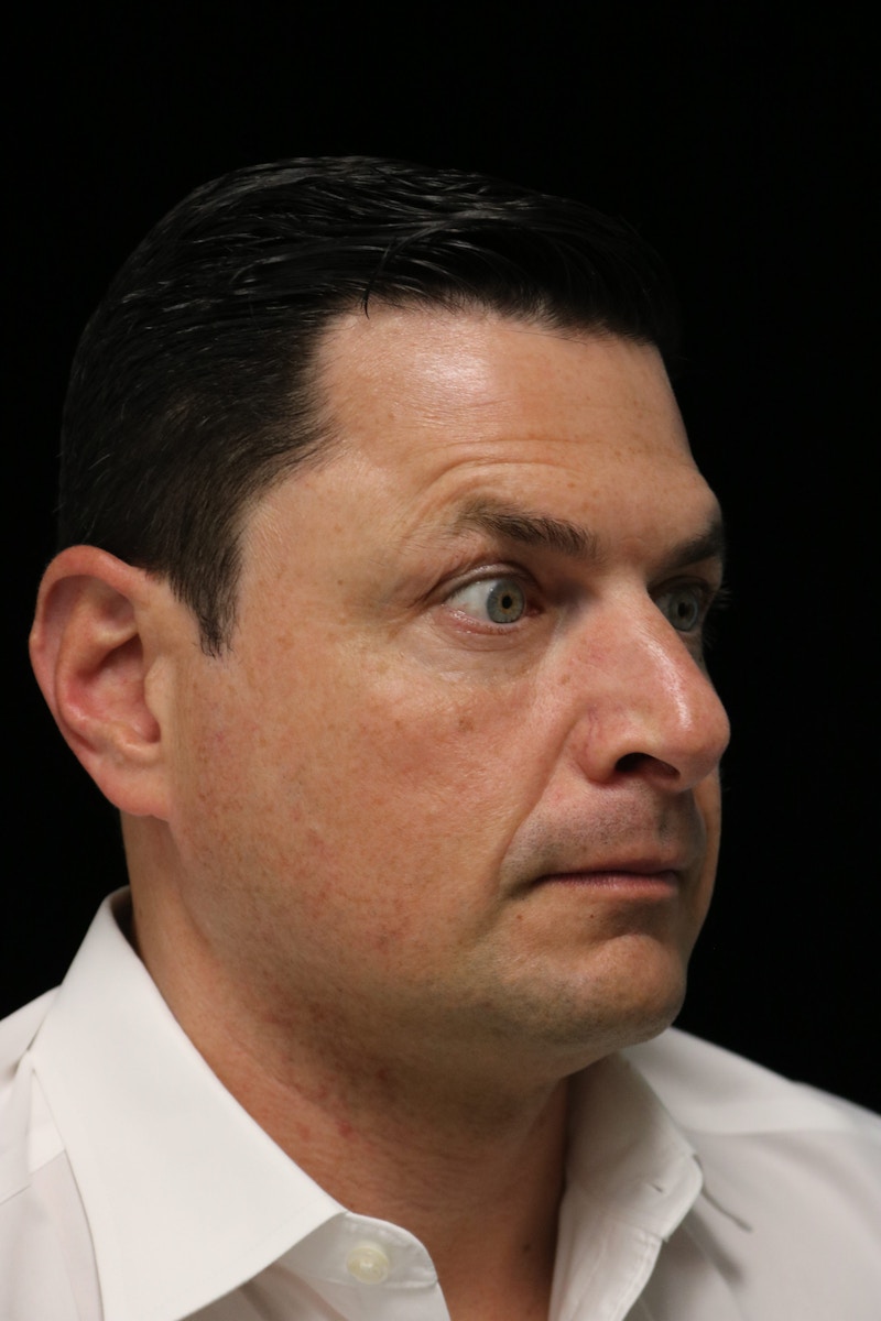 Beverly Hills Non-Surgical Before & After Gallery - Patient 406256 - Image 22 Dr. Deepak Raj Dugar