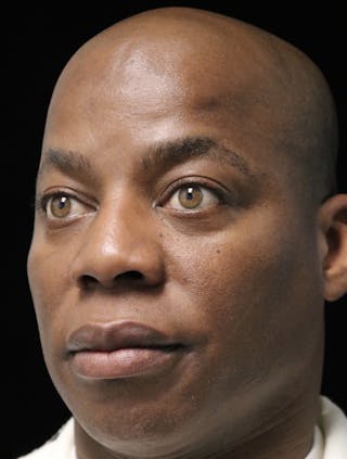 Beverly Hills Rhinoplasty Before & After Gallery - Patient 373022 - Image 8 Dr. Deepak Raj Dugar