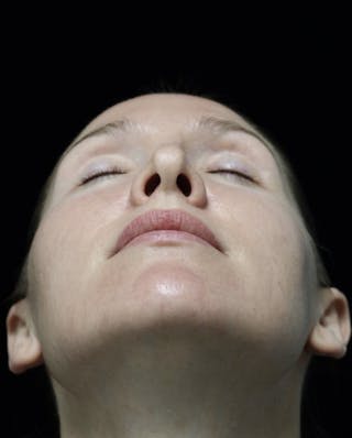 Beverly Hills Rhinoplasty Before & After Gallery - Patient 132750 - Image 14 Dr. Deepak Raj Dugar