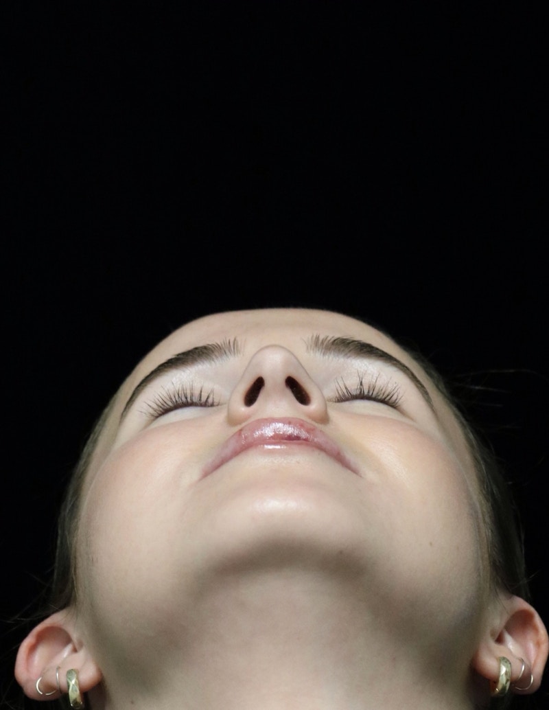 Beverly Hills Rhinoplasty Before & After Gallery - Patient 264675 - Image 13 Dr. Deepak Raj Dugar