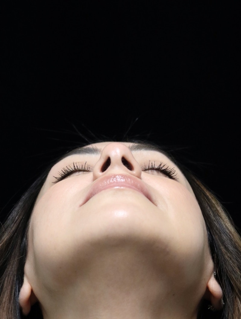 Beverly Hills Rhinoplasty Before & After Gallery - Patient 303519 - Image 14 Dr. Deepak Raj Dugar