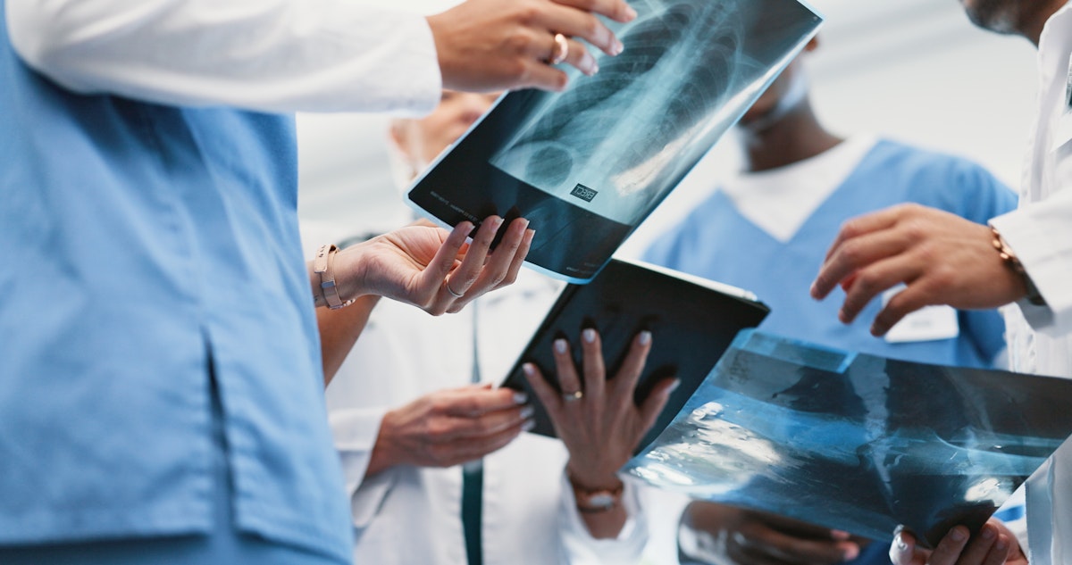Doctors looking at scans