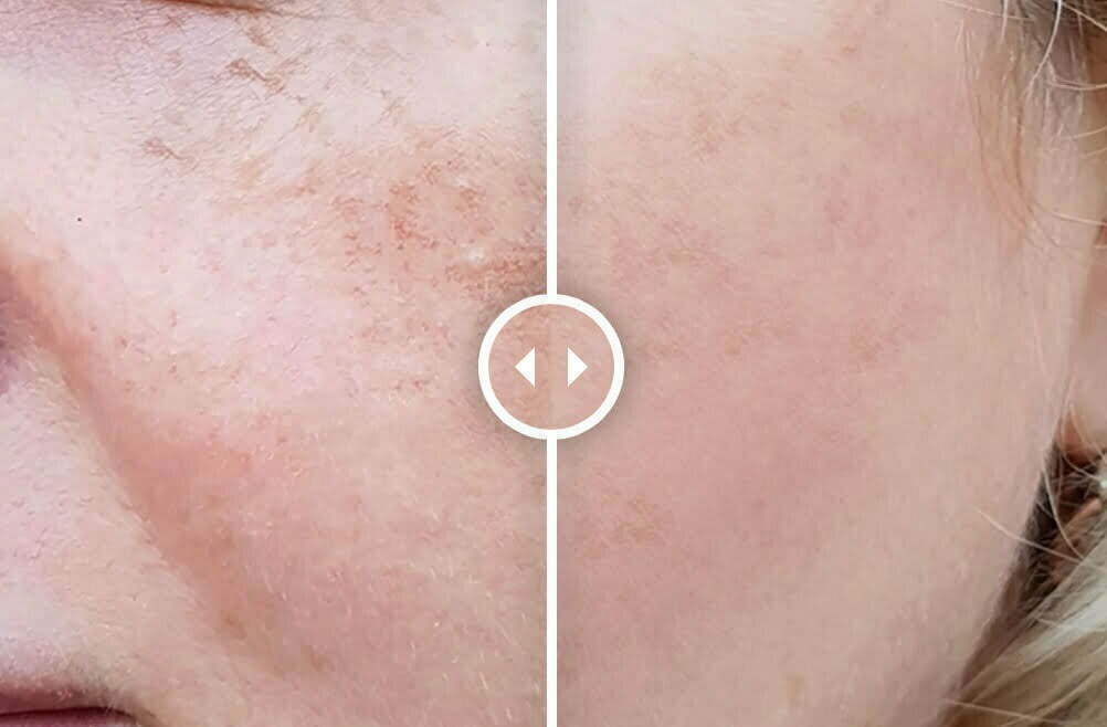 patient results