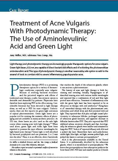 Treatment of Acne Vulgaris With Photodynamic Therapy