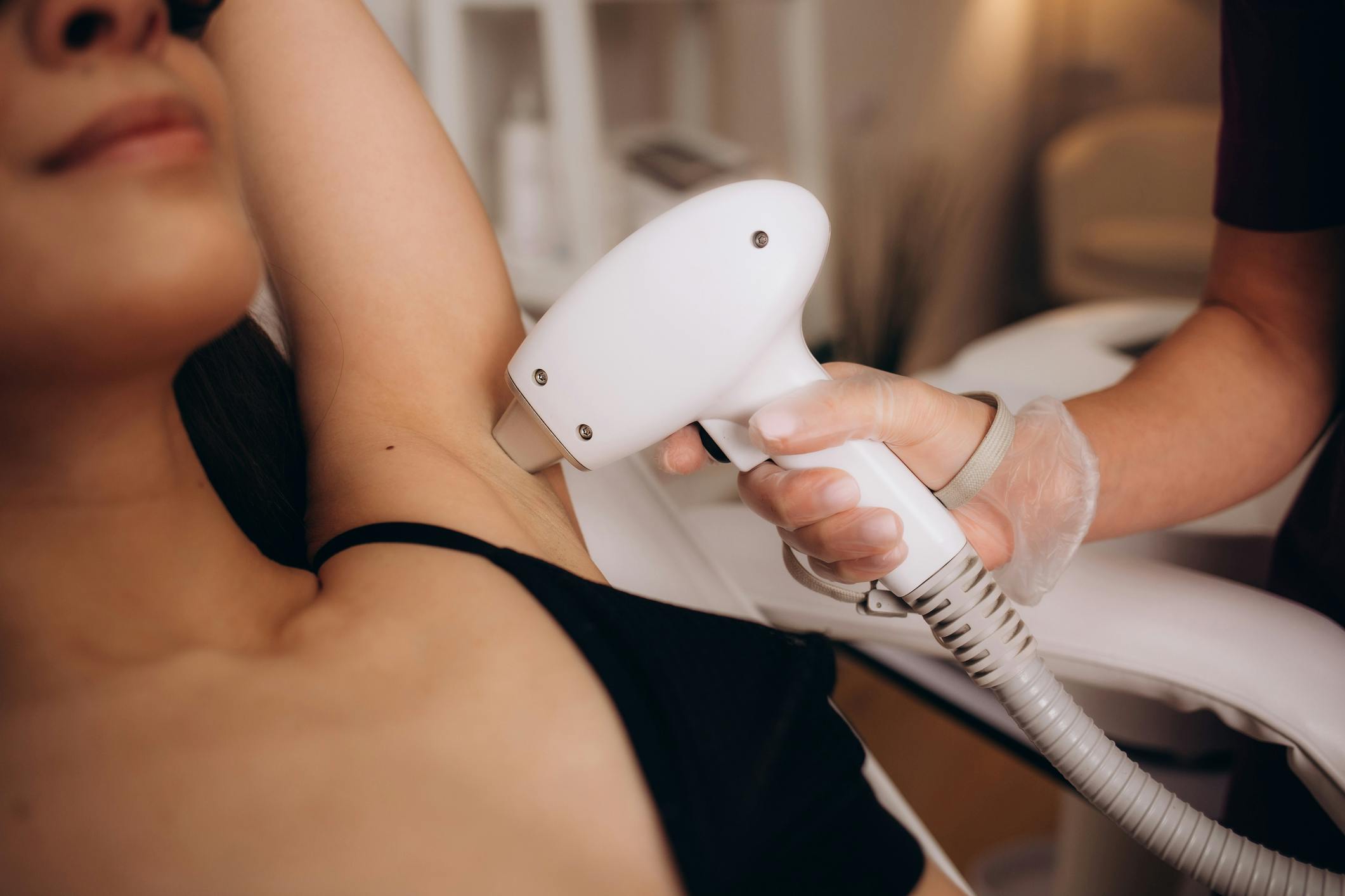 woman getting laser hair removal