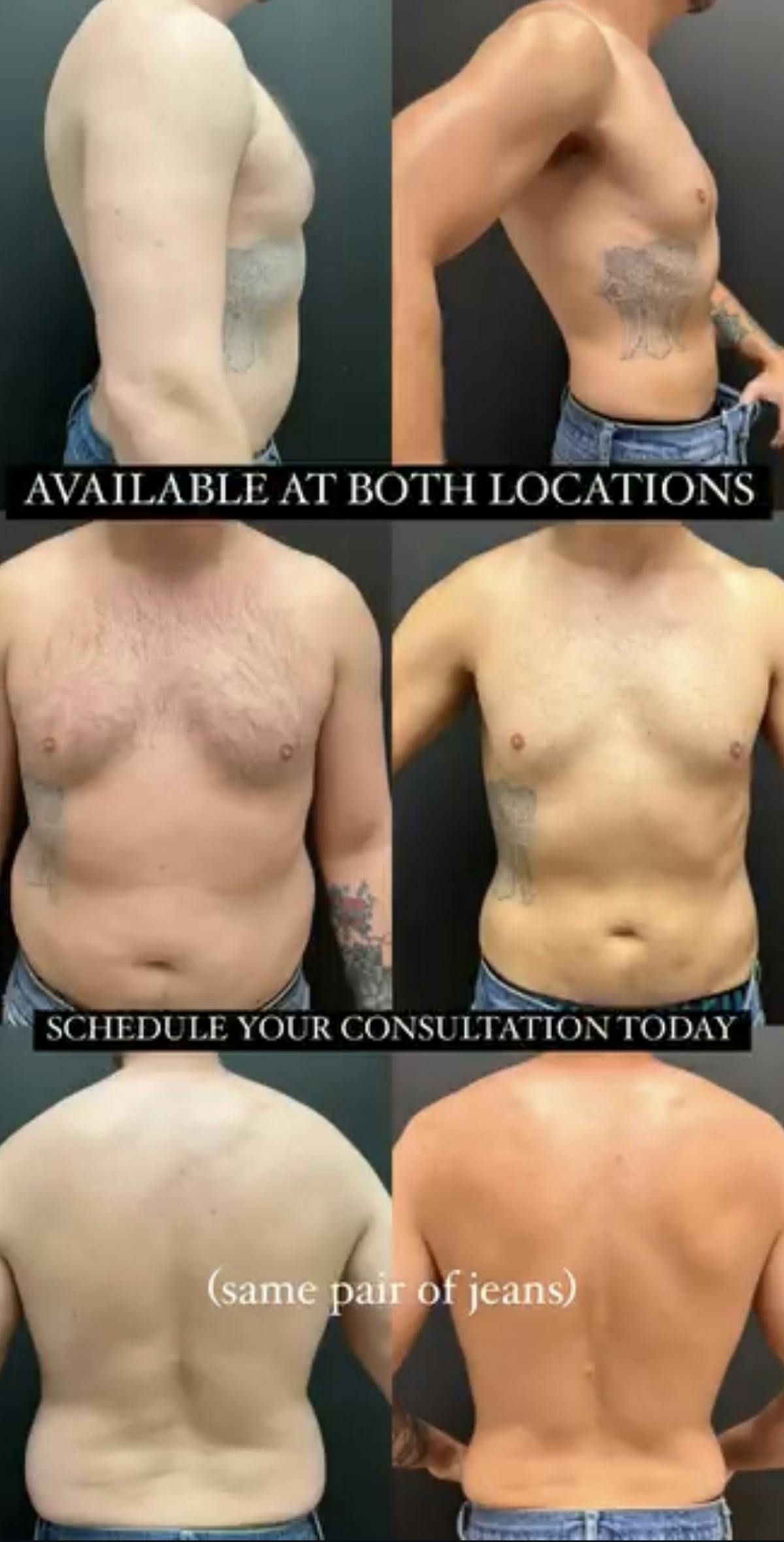 Weight Loss Before & After Gallery - Patient 186250 - Image 1