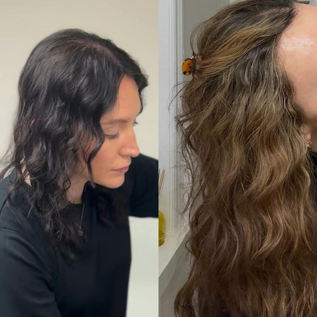 Hair Loss Before & After Gallery - Patient 806019 - Image 1