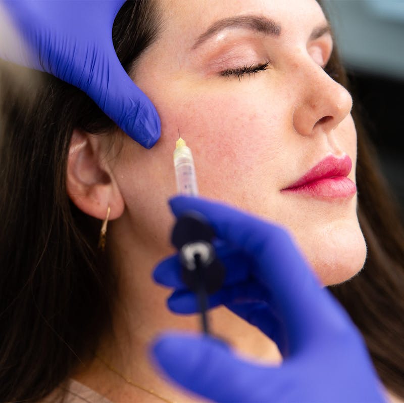 Woman receiving neurotoxin injection