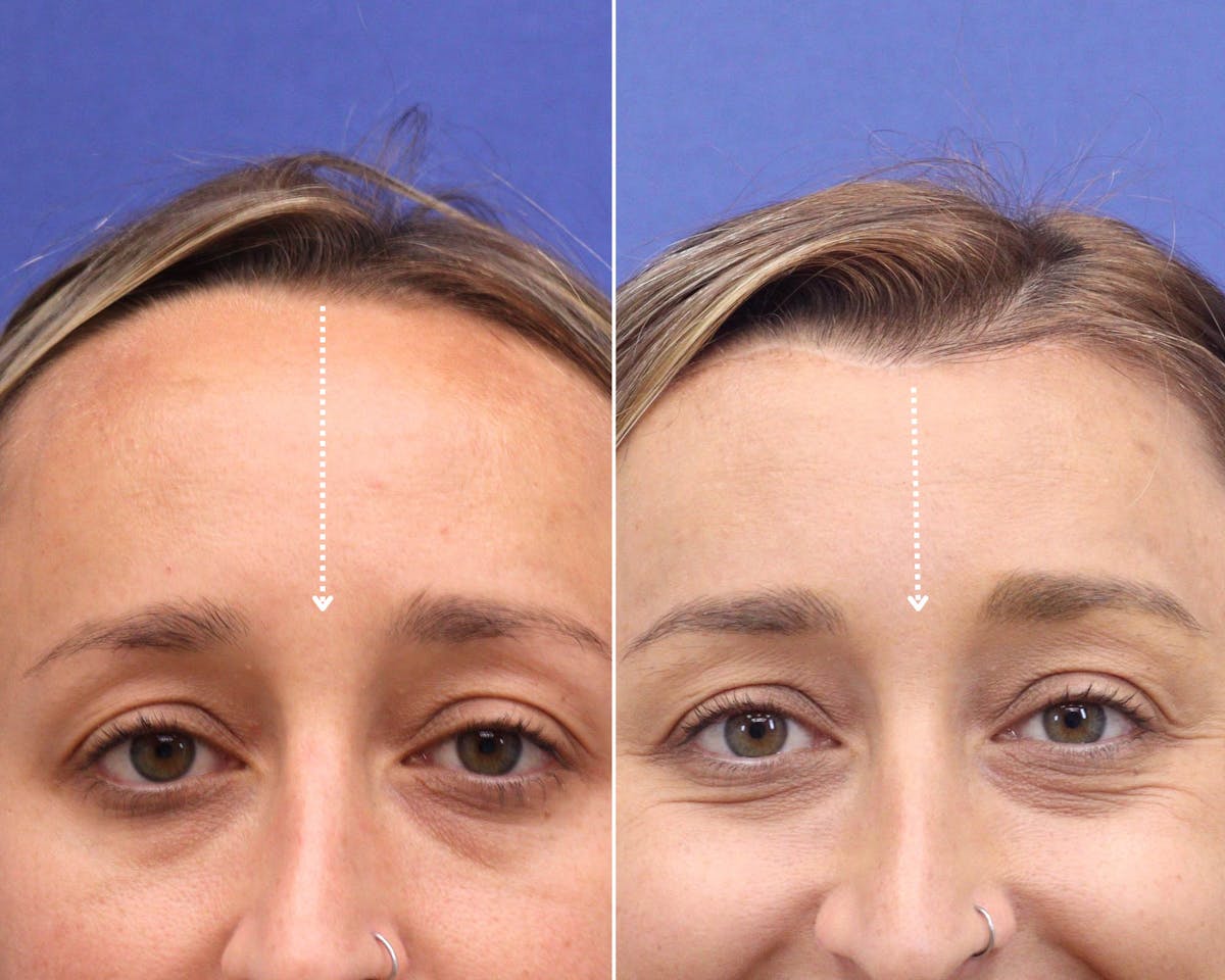 Face Before & After Gallery - Patient 291002 - Image 1