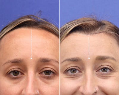 Face Before & After Gallery - Patient 291002 - Image 1