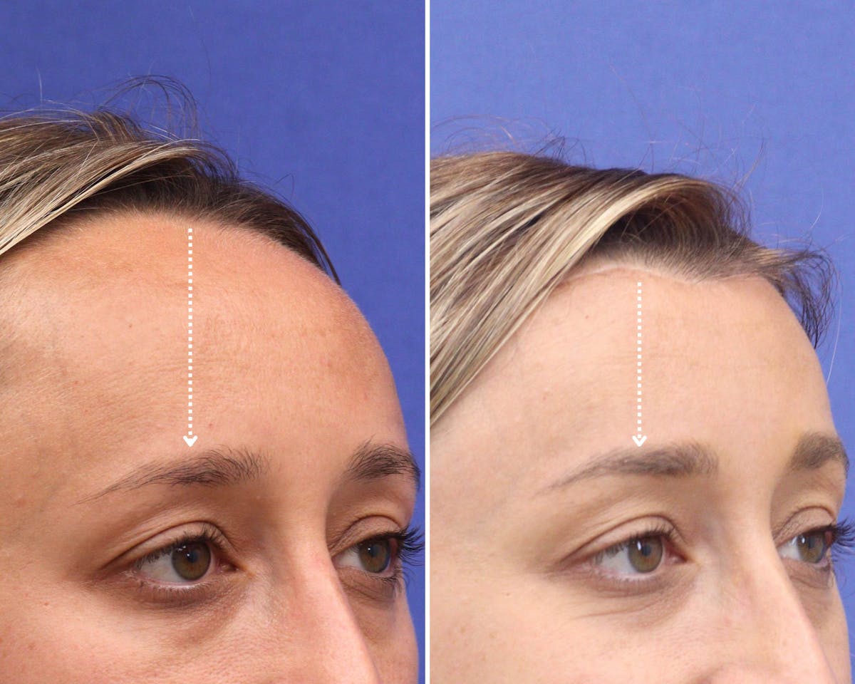 Face Before & After Gallery - Patient 291002 - Image 2